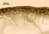 3 - Dettaglio della zona  corticale con tetrasporociste
